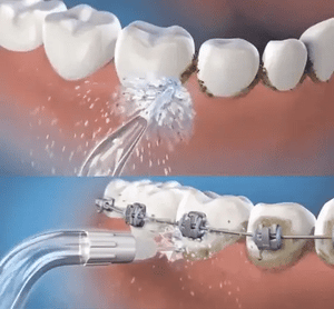 ORALWAVE™ - Irrigador bucal portátil - Limpieza profunda + OBSEQUIO