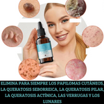 VERALIS™ - Dile adios a las verrugas y cuida tu piel + Envio Gratis